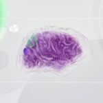 he current treatment of cortical malformations in the anterior parts of the brain, or cerebrum, in vertebrates by its surgical removal to cure epilepsy left scientists with one question. What causes these patches?
