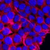 Daraxonrasib belongs to a new class of therapies known as RAS(ON) multi-selective inhibitors.