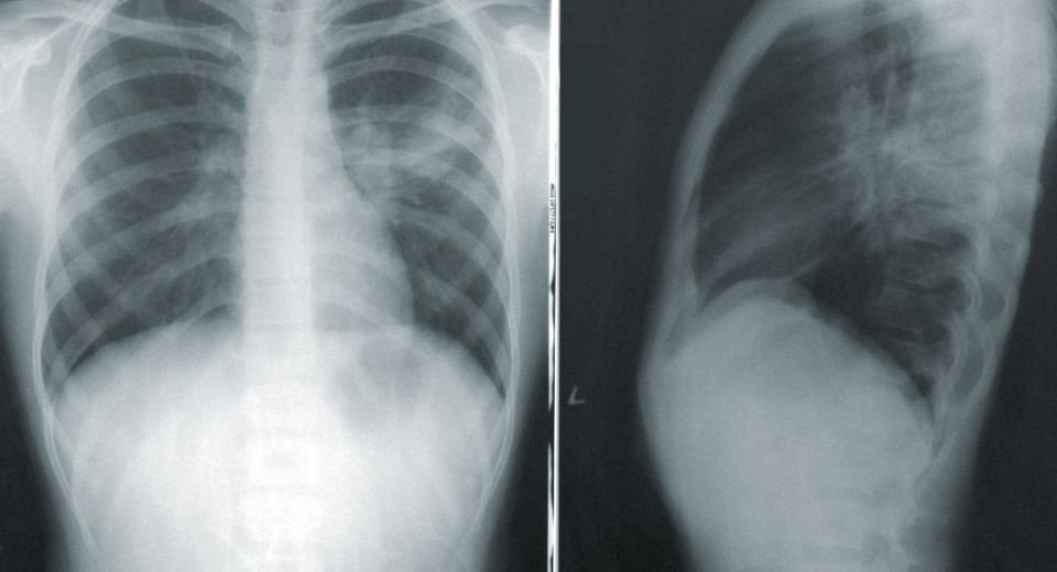 Japan’s radiologists using chest radiographs developed an AI model to accurately predict a human’s chronological age and detect chronic diseases.