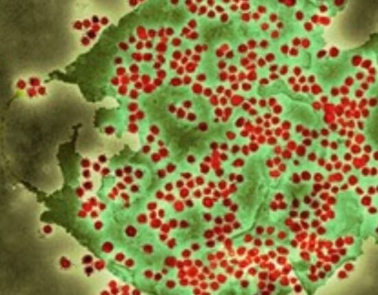 The UK reported its first variant of COVID-19 virus, BA.2.86, three days ago, which suggests “a degree of community transmission” within the country as the patient had no travel history, according to a government health agency.