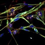 Scientists have converted cancer cells to healthy ones to treat a devastating pediatric cancer through a method called differentiation therapy.