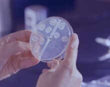 The WHO’s rapid test will be used as the first method to diagnose tuberculosis and the global health agency will license one TB vaccine in a bid to reach 90% of the patients and to end the epidemic.