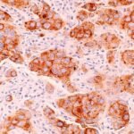 The Food and Drug Administration has approved Pfizer Inc.’s treatment for metastatic non-small cell lung cancer.