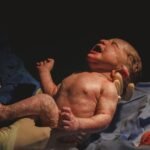 More than 3,700 babies in the US were born with syphilis in 2022 — ten times the number in 2012 — and people from racial and ethnic minorities bore the brunt of the epidemic eight times more than White mothers.