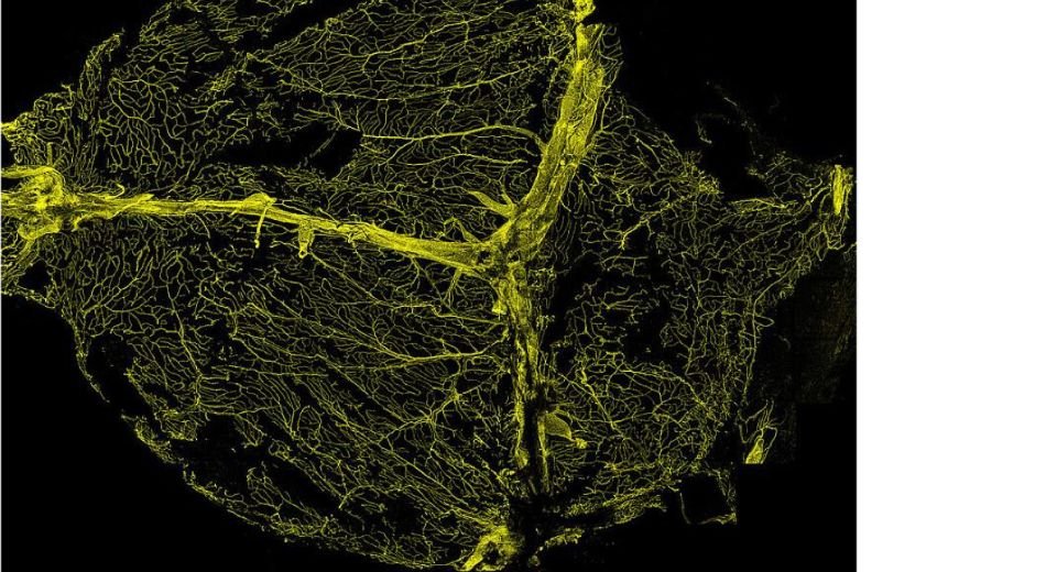 Fluorescent staining reveals the extensive network of blood vessels of the dura mater. These vessels contain T cells that, in a mouse model of chronic high blood pressure, become activated and produce conditions that can lead to dementia-like symptoms.Image courtesy of the Iadecola lab.