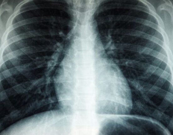 Scientists have developed a drug to treat malignant pleural mesothelioma, a fatal form of cancer that affects the lining of organs.
