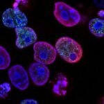 British drugmaker, GSK Plc.’s multiple myeloma drug, Blenrep, reduced the risk of disease progression or death by about 50% when compared to a standard-of-care combination, according to the company.