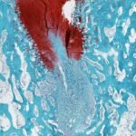 Scientists at Northwestern University's Simpson Querrey Institute for BioNanotechnology have invented a bioactive material to successfully regenerate cartilage in the knee joints of sheep.