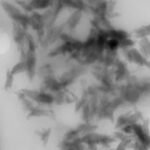 Environmental micro and nanoplastics (MNPs) accumulate in the human brain and total mass concentrations have risen by more than 50% in the past eight years, a study reveals.