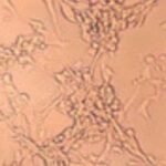 A new strain of monkeypox virus named as MPXV clade Ib, which originated in the Democratic Republic of the Congo recently, is behind the surge of cases reported and transmitted through sexual contact.