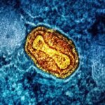 The US national public agency has issued a Health Alert Network on the ongoing outbreak of the Clade I monkeypox virus, warning its nationals to avoid sex and proximity with an infected person.