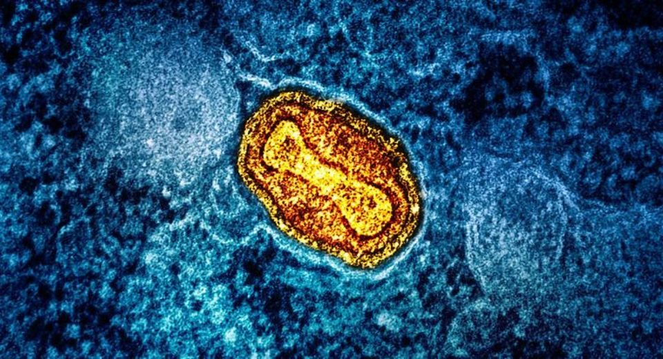 The US national public agency has issued a Health Alert Network on the ongoing outbreak of the Clade I monkeypox virus, warning its nationals to avoid sex and proximity with an infected person.