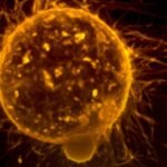 Merck & Co., announced its trial drug along with a combination of the company’s Keytruda therapy failed to meet the main goal of overall survival in patients previously treated for a type of metastatic colorectal cancer.