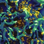 The National Instituted of Health, US, has started a mid-stage clinical trial to examine the safety and acceptability of a rectal microbicide douche containing the antiretroviral drug tenofovir to prevent HIV infection spread among men.
