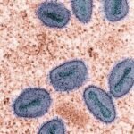 Britain has detected two cases of Clade Ib mpox, a variant, in household contacts of the first case, taking the total to three since last week, according to the UK Health Security Agency (UKSHA).