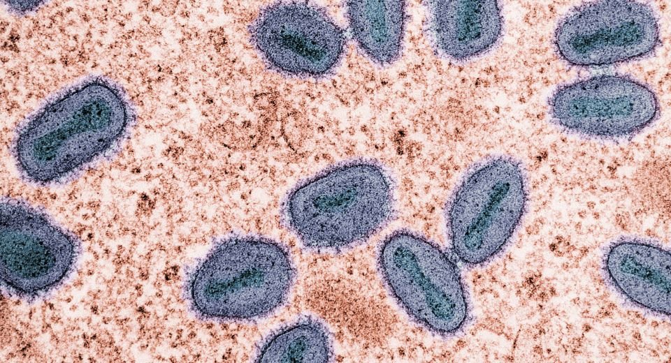 Britain has detected two cases of Clade Ib mpox, a variant, in household contacts of the first case, taking the total to three since last week, according to the UK Health Security Agency (UKSHA).