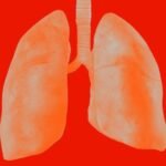 Johnson & Johnson’s combination therapy for treating a certain form of cancer without chemotherapy, has been shown to extend patients' lives by more than a year, according to a company statement.