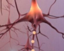 US adults who will develop dementia every year will rise to one million in 2060 from 514,000 in 2020, according to a study published in Nature Medicine.