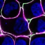US scientists have blocked a protein that kills a variety of cancer cells in an experiment on mice, pointing to a new potential target for cancer treatment, according to the National Institutes of Health.