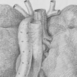 The Cystic Fibrosis Foundation will invest up to $2.3 million in Owlstone Medical to develop a test that is designed to detect Pseudomonas infections from a person’s breath.