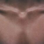 Eneboparatide (AZP-3601) meets its primary goal in the CALYPSO Phase III trial, offering hope for chronic hypoparathyroidism patients.