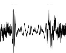 Cambridge researchers have invented a device to record heart sounds accurately and diagnose coronary valve diseases better than traditional stethoscopes.