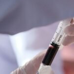 The US Food and Drug Administration has granted marketing access to Fujirebio Diagnostics, Inc.’s blood test to diagnose Alzheimer’s disease, the first such approval in the country.