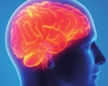 A group of US professors has developed a method to accurately diagnose and treat traumatic brain injuries, providing more rigorous care and preventing premature discussions about halting life support.