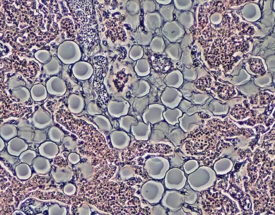 Mice treated with a special protein called Klotho for a year showed marked improvements in longevity and physical health, opening up potential therapies for humans.
