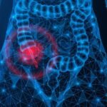 Appendiceal cancer tripled in Americans born between 1976 and 1984 and quadrupled for those born between 1981 and 1989, according to a study.