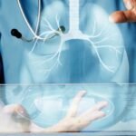 The US Food and Drug Administration has approved Nuvation Bio Inc.’s medicine for adults who have a rare type of lung cancer caused by a specific genetic change.