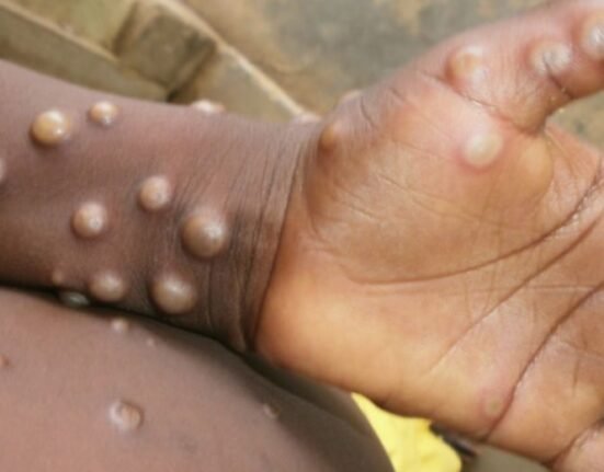 Mpox cases continue to surge and meet the criteria of a public health emergency of international concern, the World Health Organization stated.