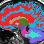 Scientists can tell how fast or gracefully you are ageing from a single magnetic resonance image of your brain, according to researchers at Duke University.