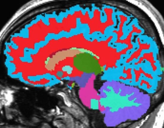 Scientists can tell how fast or gracefully you are ageing from a single magnetic resonance image of your brain, according to researchers at Duke University.