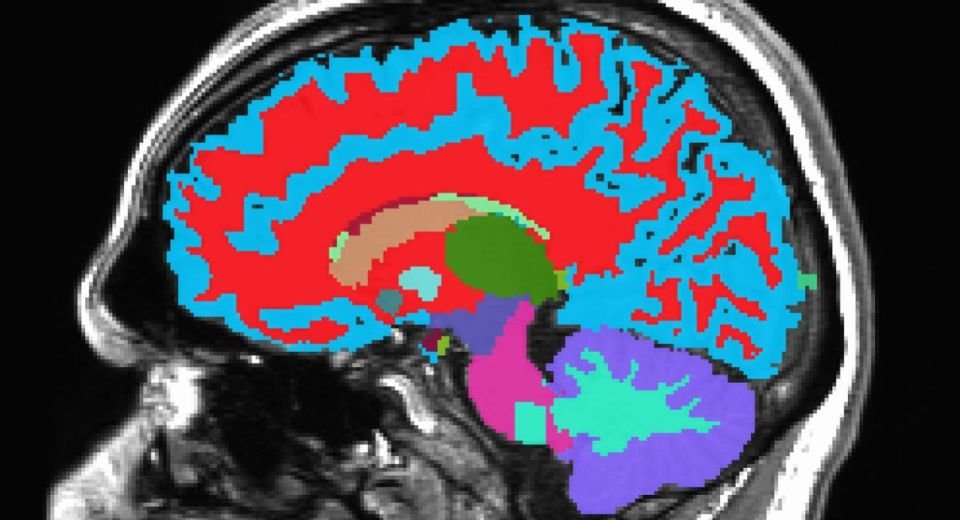 Scientists can tell how fast or gracefully you are ageing from a single magnetic resonance image of your brain, according to researchers at Duke University.
