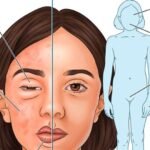 KalVista Pharmaceuticals Inc.'s medicine to treat hereditary angioedema, a rare disease that causes sudden and severe swelling attacks in the body, got approval from the US regulator.
