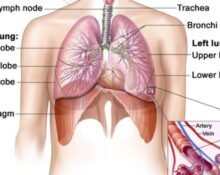 Medical experts at Cincinnati Children’s have made an organoid, or ‘organs in a dish,’ of human lung tissue that produces its own blood vessels, according to a statement.