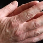 Johnson & Johnson has stopped a mid-trial evaluation of a combination drug to treat people with a type of arthritis after the therapy failed to show “sufficient evidence” of benefit to the patients.