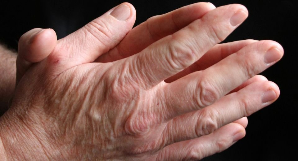 Johnson & Johnson has stopped a mid-trial evaluation of a combination drug to treat people with a type of arthritis after the therapy failed to show “sufficient evidence” of benefit to the patients.