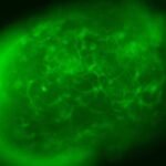 Excess fat present in the brain’s immune cells impairs their ability to combat diseases such as Alzheimer’s, research from US-based Purdue University reveals.