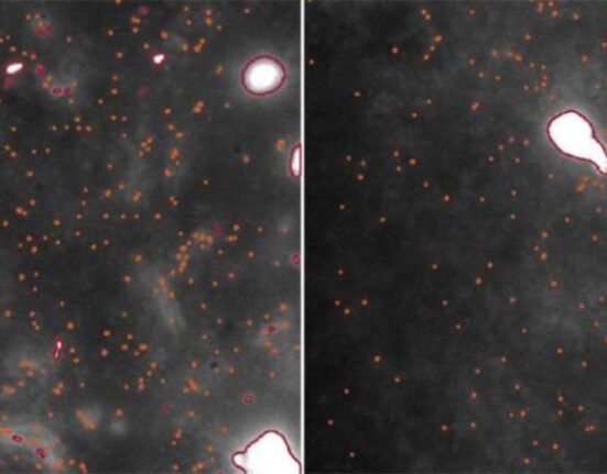 University of Cambridge scientists have developed a first-time imaging technique that helps visualise and quantify the early triggers of Parkinson’s — the world’s fastest-growing neurological disease.