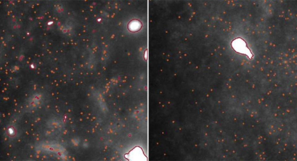 University of Cambridge scientists have developed a first-time imaging technique that helps visualise and quantify the early triggers of Parkinson’s — the world’s fastest-growing neurological disease.