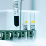 Six small ribonucleic acid (RNA) molecules in the blood may be able to predict short-term survival with an 86% accuracy, a study finds.