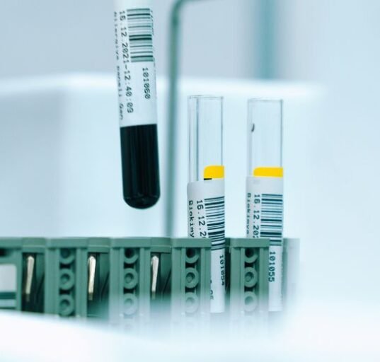 Six small ribonucleic acid (RNA) molecules in the blood may be able to predict short-term survival with an 86% accuracy, a study finds.