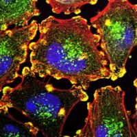 Australia's Telix Pharmaceuticals will buy ITM Isotope Technologies Munich SE for an upfront payment of $1.65 billion on a cash- and debt-free basis to pocket the Germany-based company’s therapeutic radioisotopic solutions.