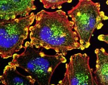 Australia's Telix Pharmaceuticals will buy ITM Isotope Technologies Munich SE for an upfront payment of $1.65 billion on a cash- and debt-free basis to pocket the Germany-based company’s therapeutic radioisotopic solutions.